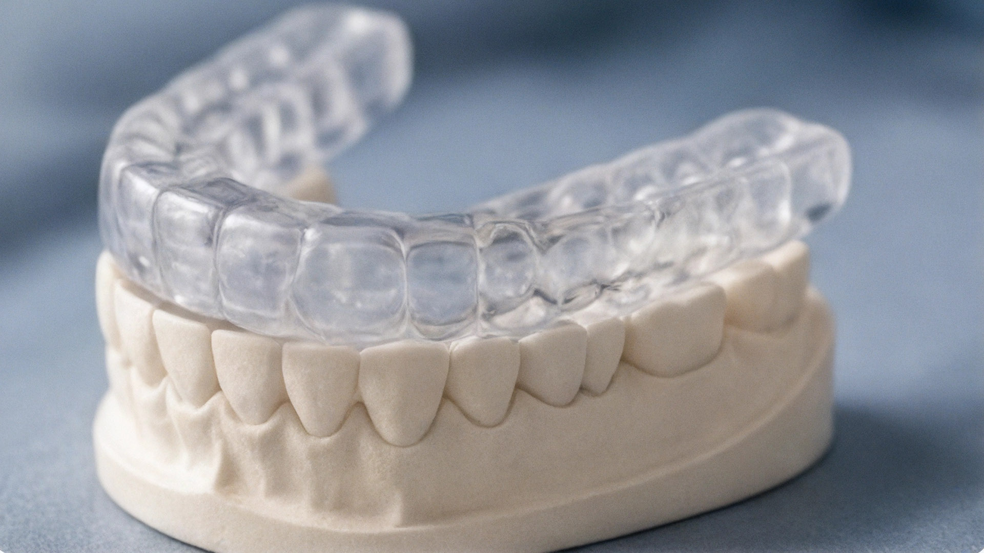 Bite dentale: quando il sorriso ha bisogno di equilibrio