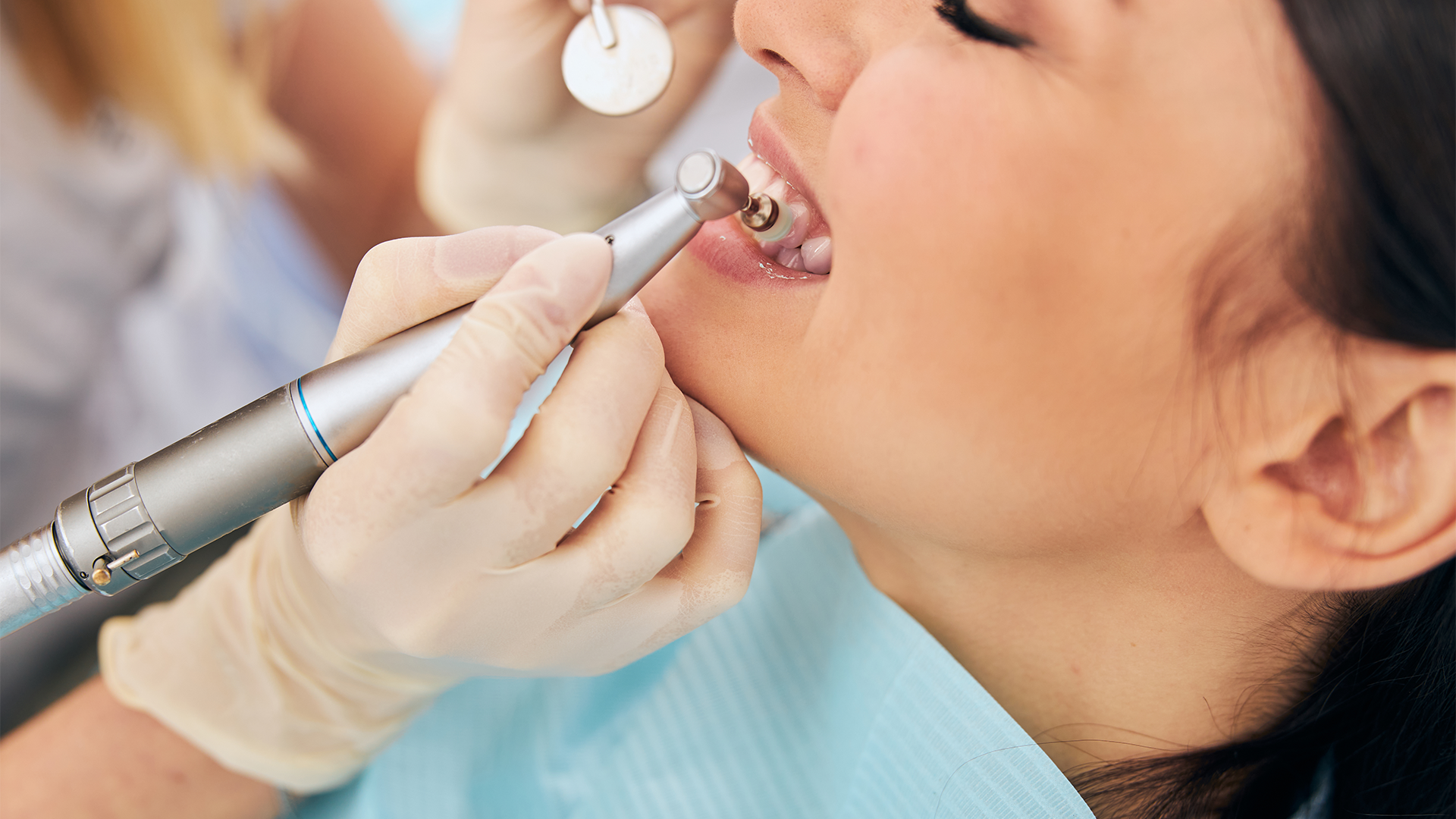 Pulizia denti a Roma: ogni quanto farla e perché è fondamentale per la salute orale