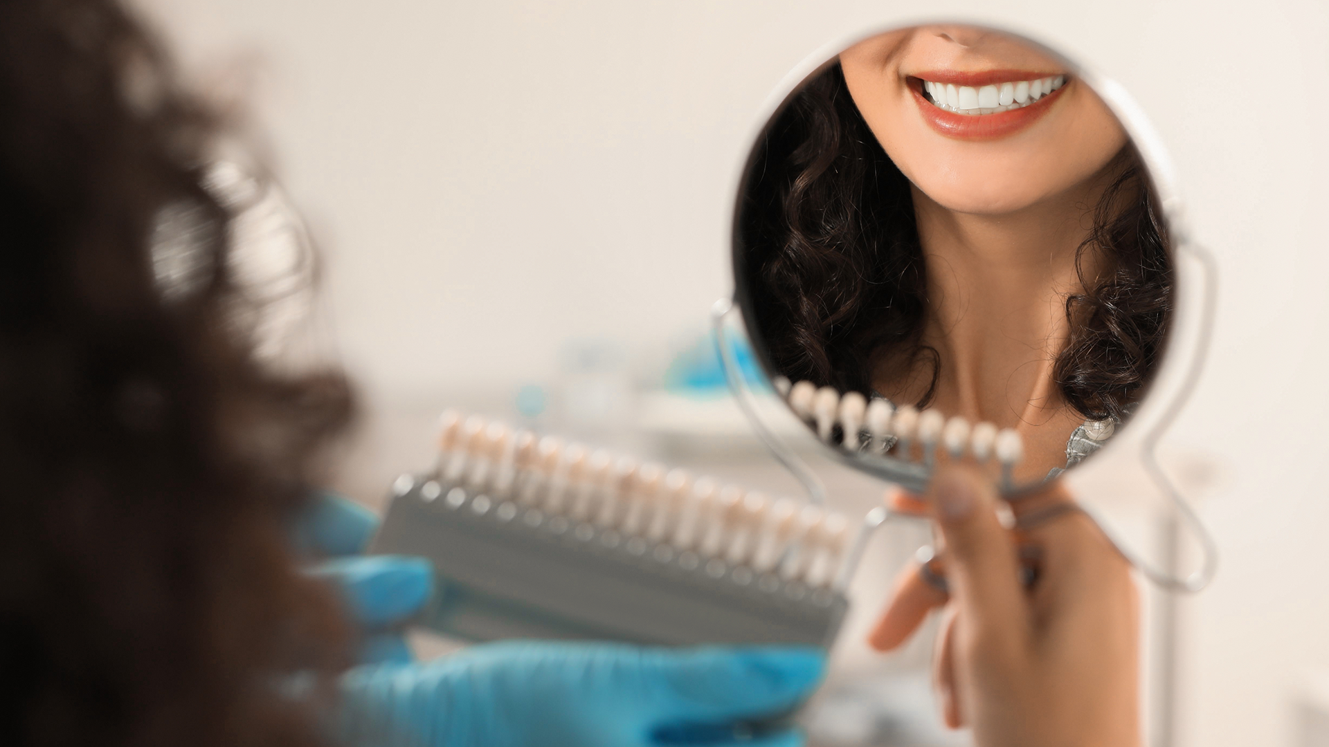 Sbiancamento dentale professionale a Roma: quello che le foto  prima/dopo non dicono
