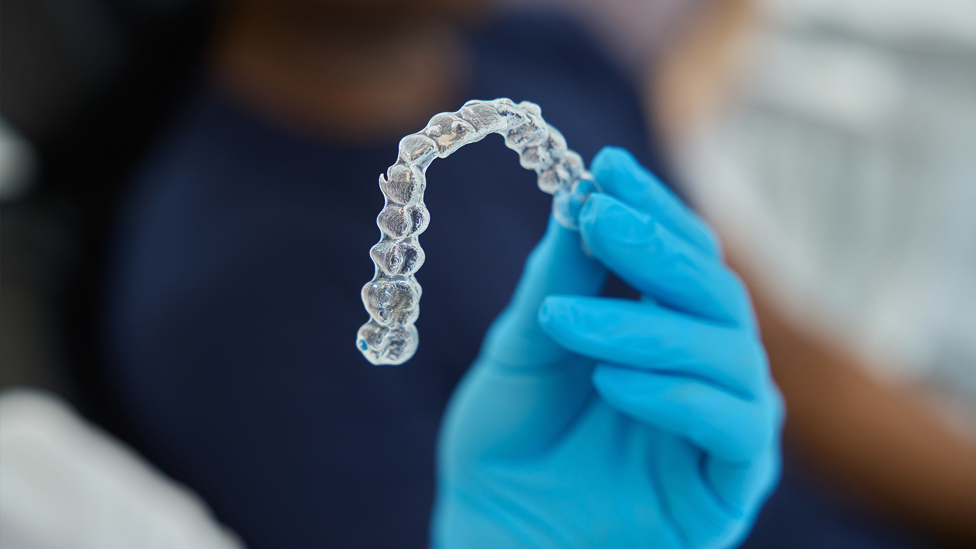 Simulazione allineatori trasparenti: puoi vedere prima come cambierà il tuo sorriso?